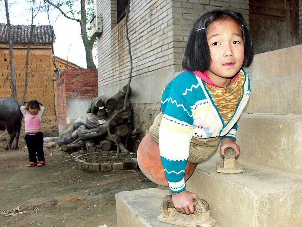 “篮球女孩”云南姑娘，4岁因车祸高位截肢，20年过去她怎么样了