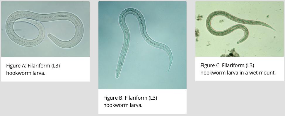 他们生吞3500寄生虫卵，花费1.5万元，只为治疗秃头