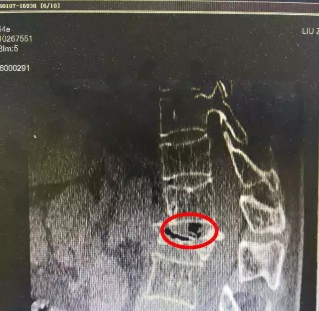 按摩椅按摩两小时瘫痪,街边按摩椅一直坐会怎么样