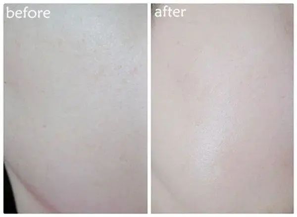 婴儿肌是怎么保养的,婴儿睡觉是身体在自我修复吗