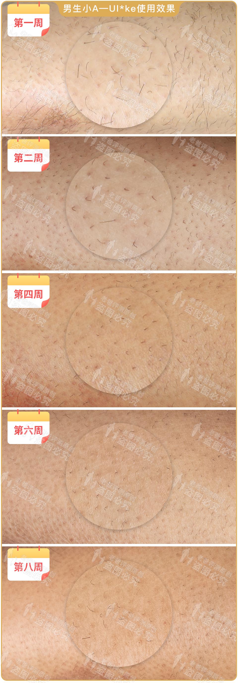 最真实的脱毛仪,bequeen脱毛仪实测