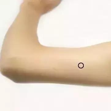 胡希恕经方治疗乳腺增生,中医治疗乳腺增生的处方