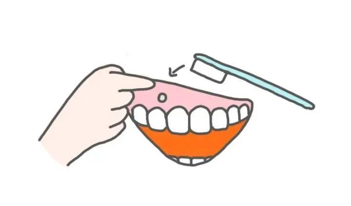 支抗钉和骨钉的区别,13岁矫正牙齿打骨钉亲身经历