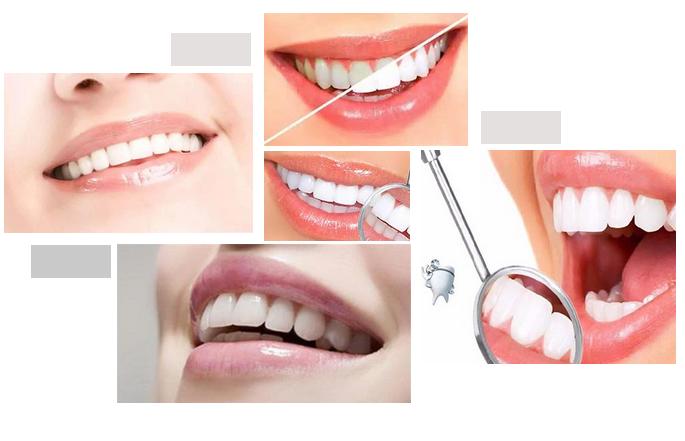 生命汇马泷齿科｜牙越来越黄，怎么办？