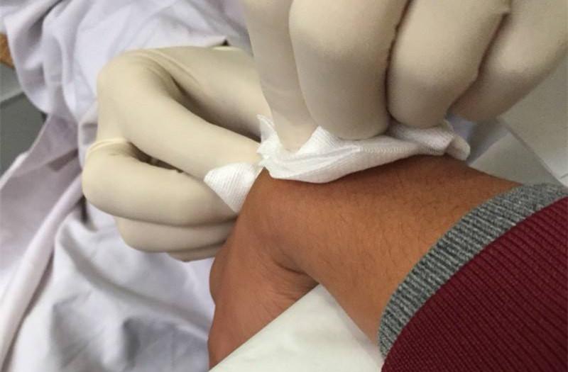 腱鞘囊肿拆线后如何护理,足背腱鞘囊肿术后怎么护理