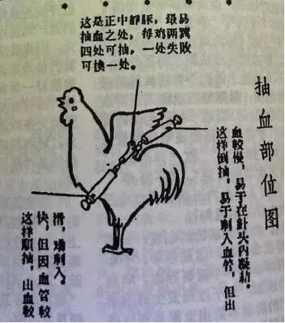 鸡血疗法历史解密,鸡血疗法