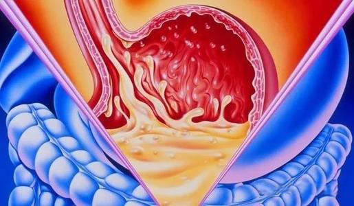 经常胃不舒服胃烧心怎么治疗,经常胃部不舒服吃什么比较养胃