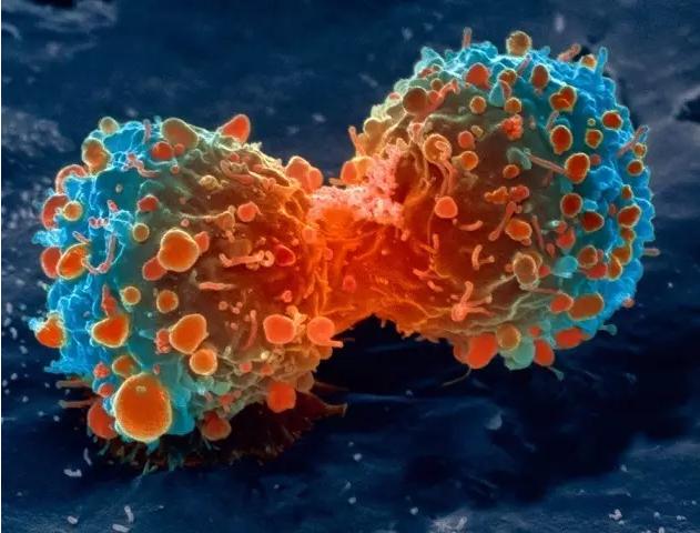 癌症怎么转移,癌症是怎么转移的图