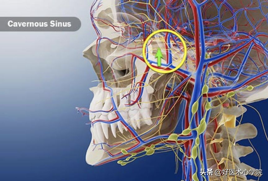 最常见的血栓类型是,最致命血栓视频
