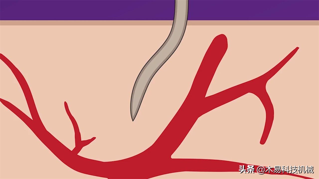 高科技灭蚊灭蟑螂小神器,自制灭蚊子神器第一名