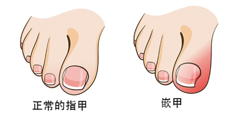 宝宝的鞋子怎么穿不会掉,宝宝穿的鞋子最好买大多少合适