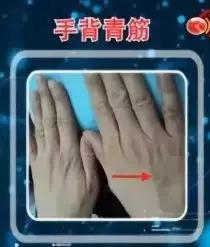 静脉血管青筋正常图片,手肚血管青筋暴露是怎么回事