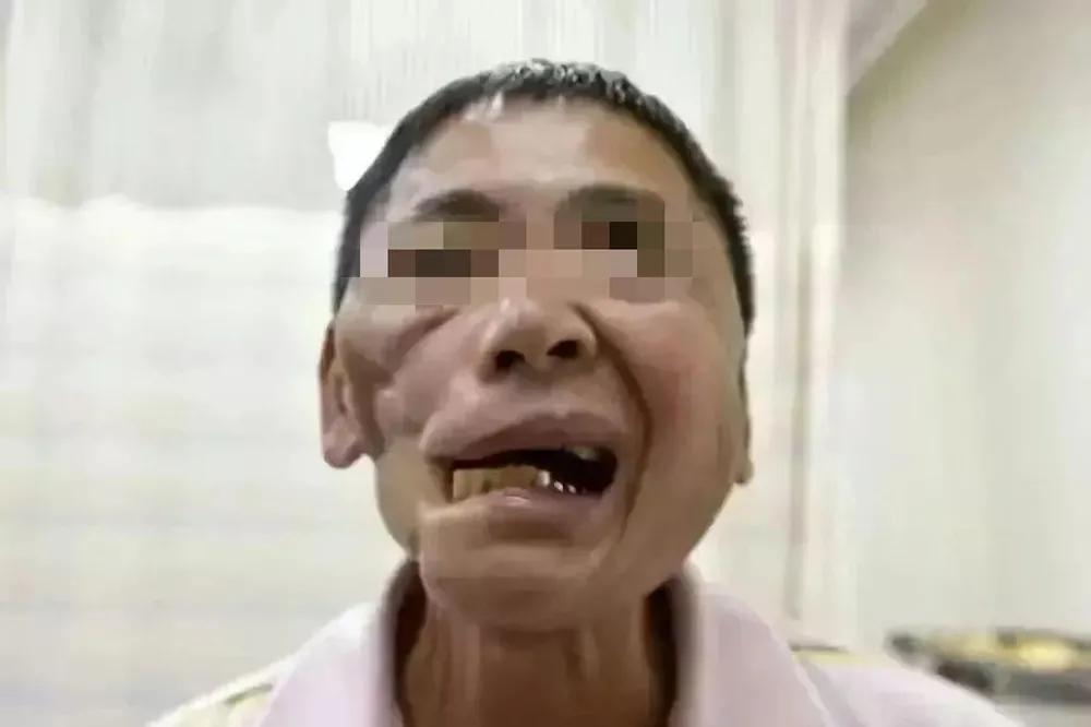 劝别人不要吃槟榔,偶尔吃槟榔有事吗