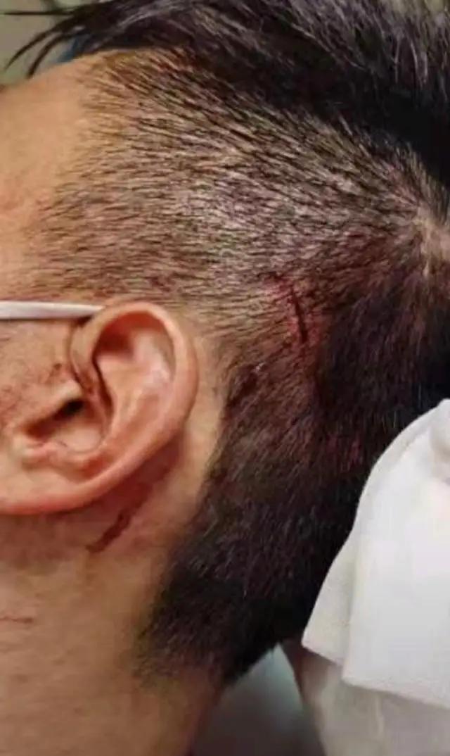 拳击比赛中国裁判怒踹日本拳手,日本拳手恶意犯规视频