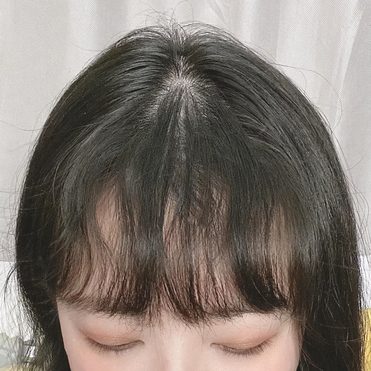 刘海怎么才能矫正,刘海矫正最好的方法