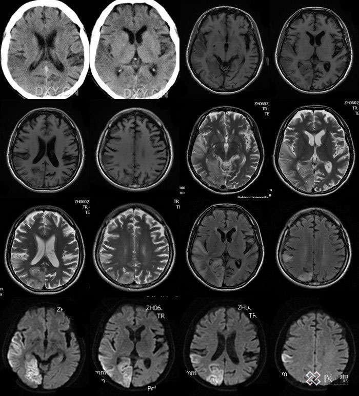iseihealth:医生提醒即使没有疼痛或不适，也不要忽视血尿