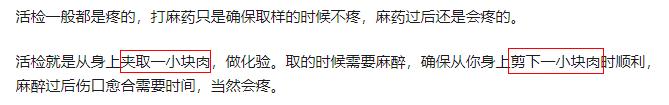 辟谣：阴道镜活检，需要剪下一块肉？
