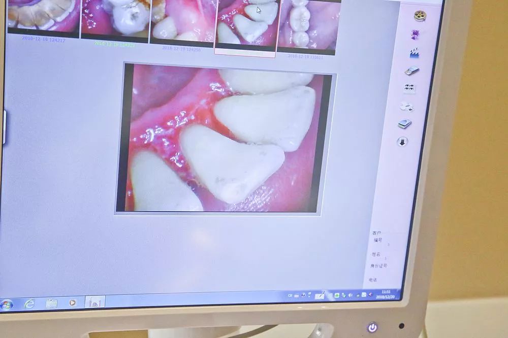 让你笑出自信的不止益达！仅39.9元抢成都华品口腔保健洁牙套餐！