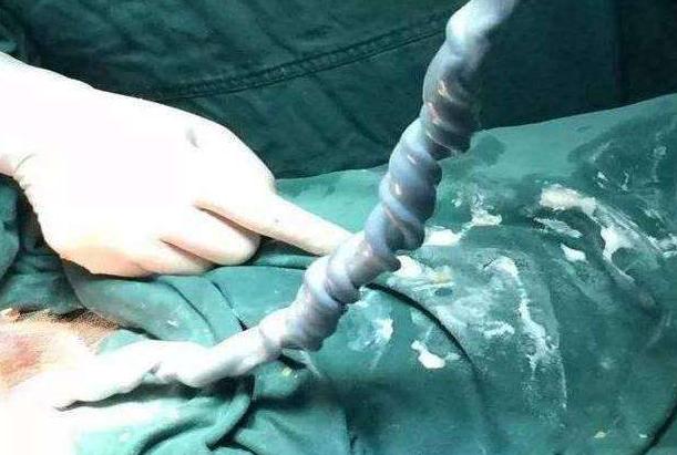 胎宝宝日常活动视频,胎宝宝运动视频