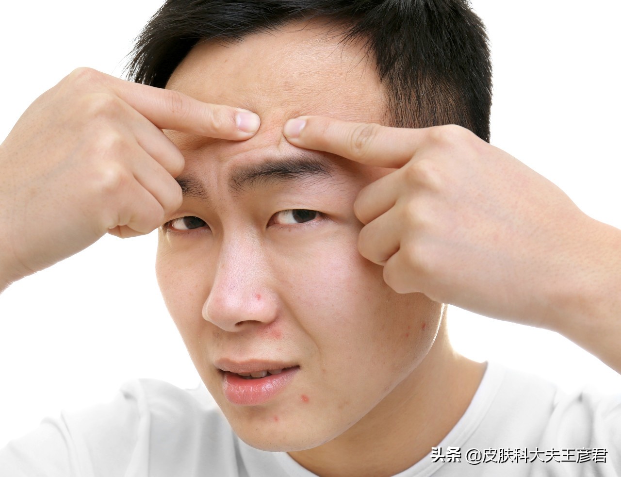 青少年脸颊两边长痘怎么解决,青少年脸上长痘痘怎么办最有效