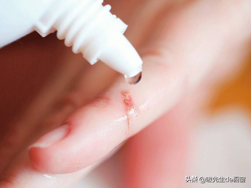 十几年前被猫咬伤没打狂犬疫苗,没被猫狗咬伤可以注射狂犬疫苗吗