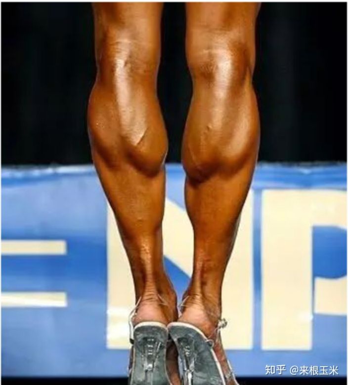 水肿腿加大象腿怎么瘦,大象腿赘肉多