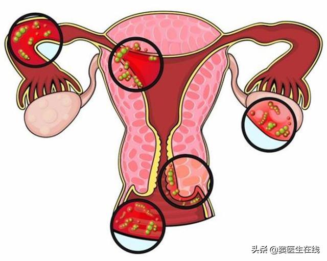 12岁女孩月经不正常是怎么回事,12岁女生没有来月经的原因是什么