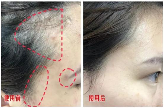 头发蓬松茶树油洗发水,油头救星澳洲茶树洗发水