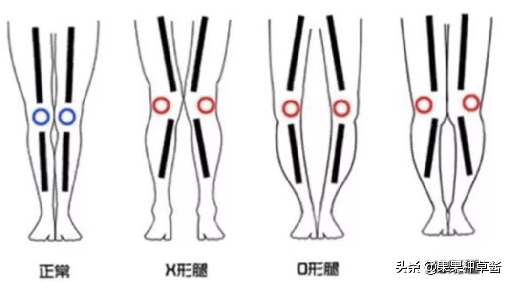 穿短裤穿什么鞋子显腿瘦,腿型不好看小个子穿什么鞋子