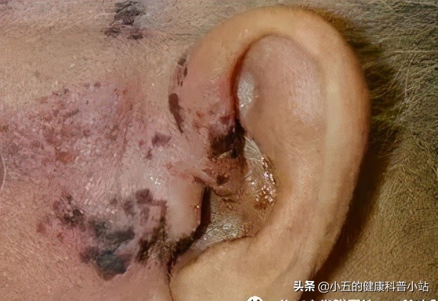 浜ㄧ壒缁煎悎寰佺殑鐗圭偣,浜ㄧ壒缁煎悎寰佺殑鐗瑰緛