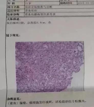 如何看懂胃镜活检报告,胃镜病理活检报告一般需几天