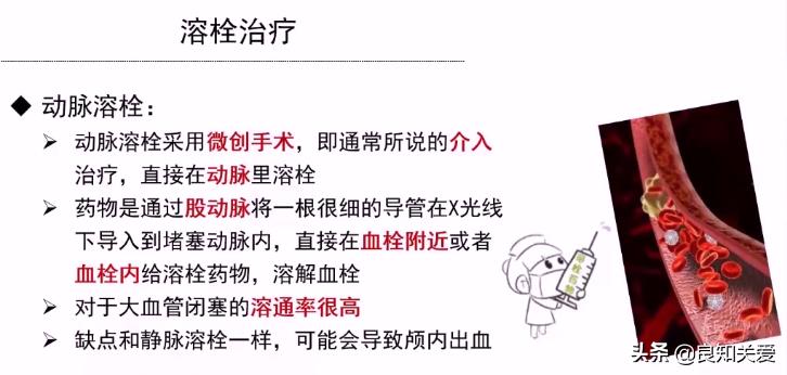 急性脑梗治疗需要多少钱,治疗急性脑梗输什么药