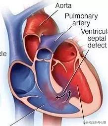 心脏说明书,这份通俗易懂的心脏说明书请收好