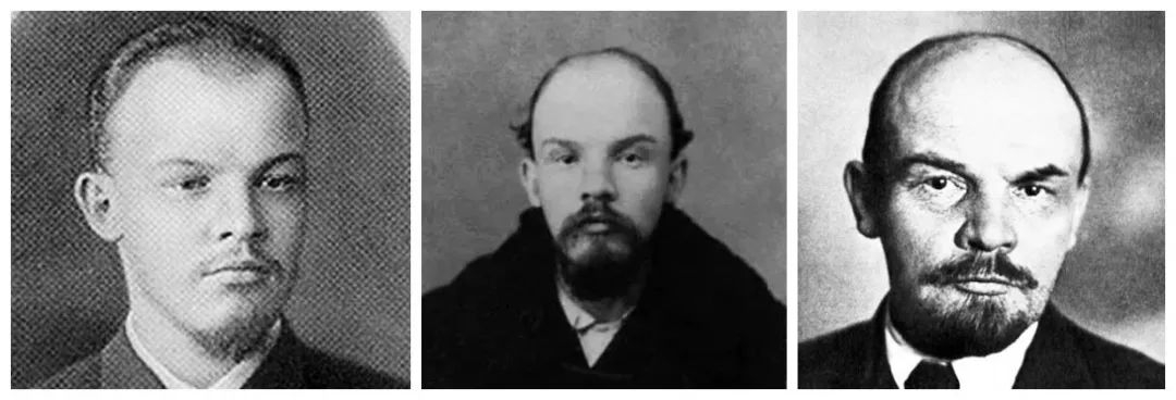 90后没有发际线,90后00后如何不脱发