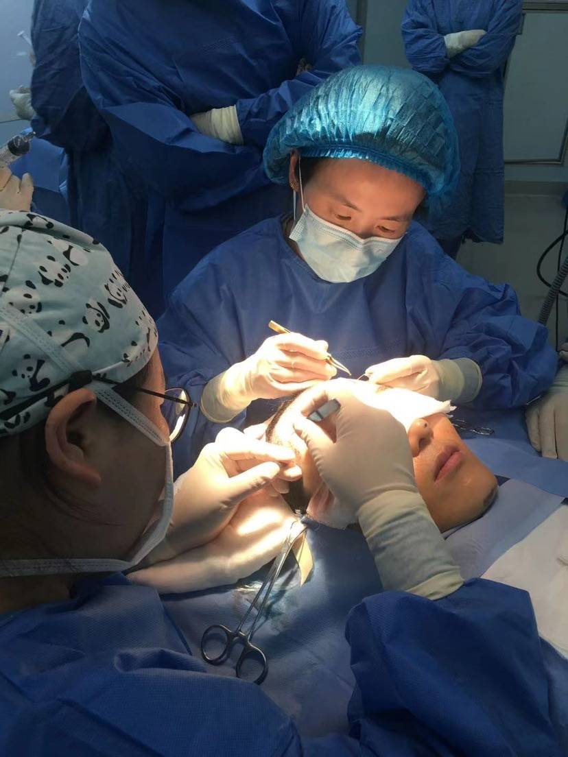 发际线特别高很自卑,自卑发际线高