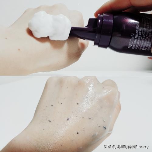 痘痘闭口粉刺去除的小妙招,痘痘粉刺闭口如何快速去除