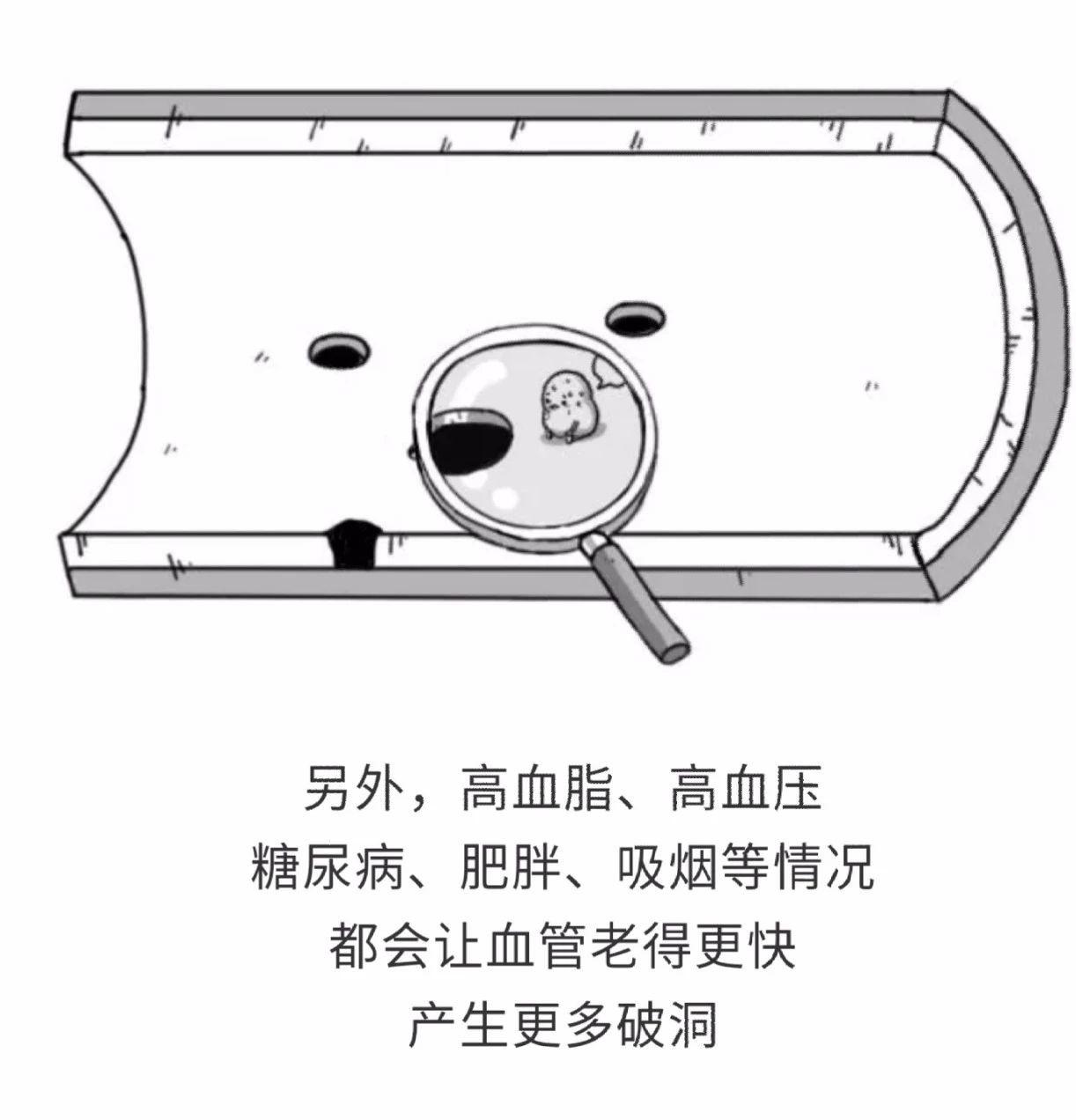「民间偏方奇效方」高脂血症