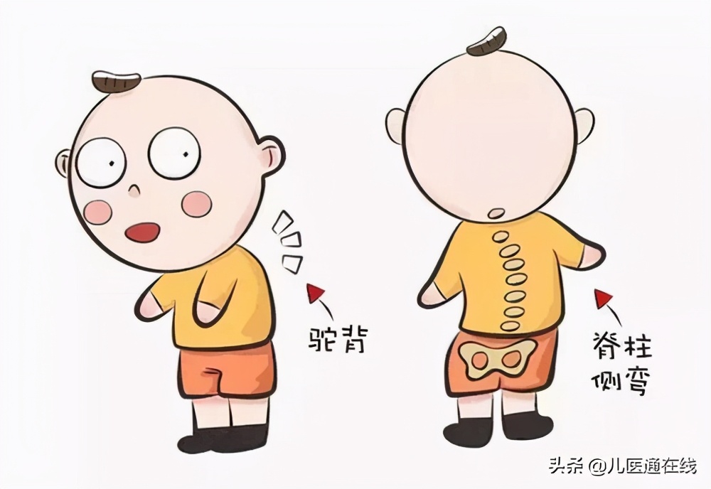 如何避免六个月宝宝脊柱侧弯,什么原因会导致宝宝脊柱侧弯