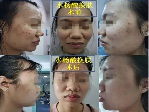 妇幼保健院国际爱肤日活动,中医医院医讯