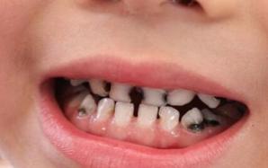 关于加大食品药品安全执法力度,开展食盐质量安全专项整治