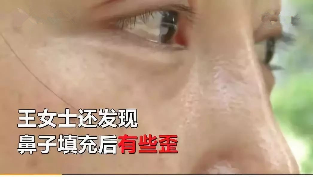 被整容毁掉女明星,被整容毁掉的中国女明星