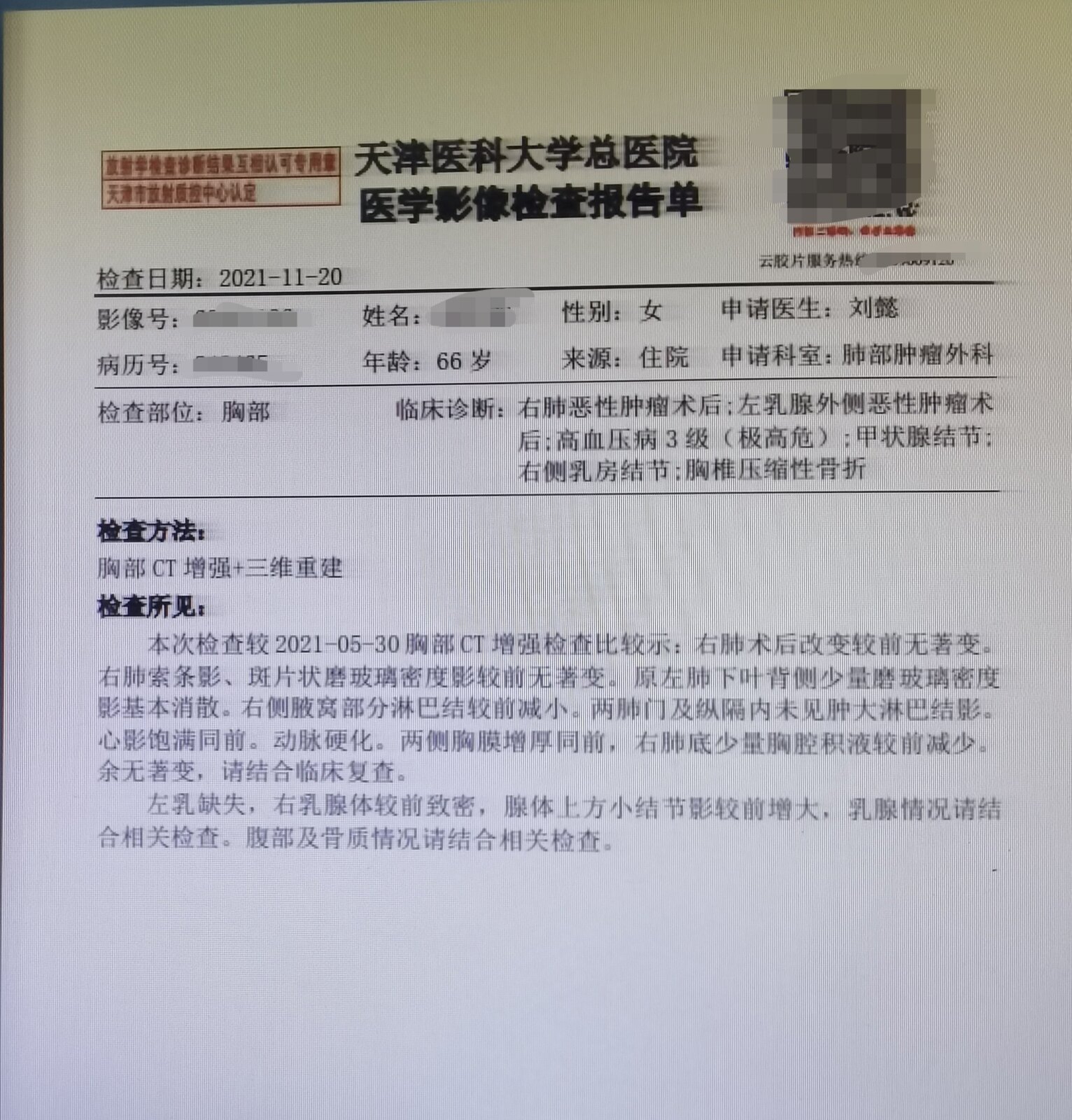 刘懿博士说肺癌,刘懿博士肺癌晚期