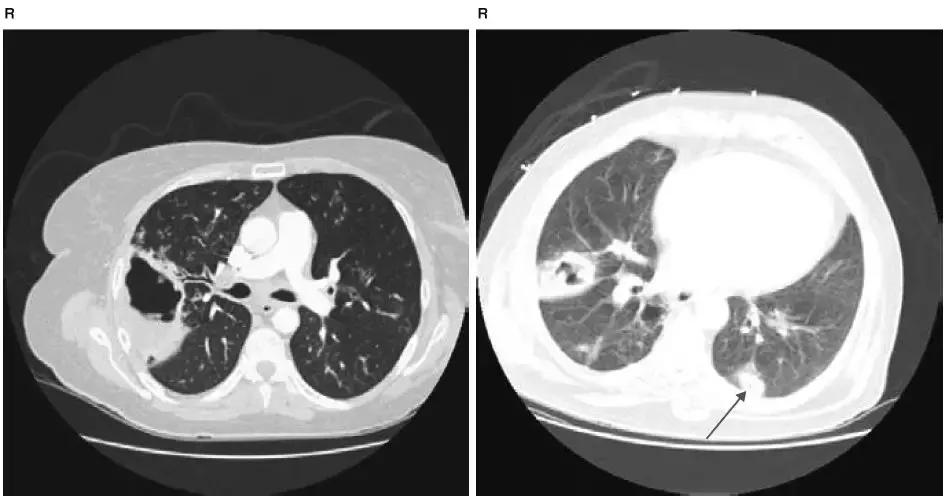 胸部影像解剖图谱书,胸部断层图谱