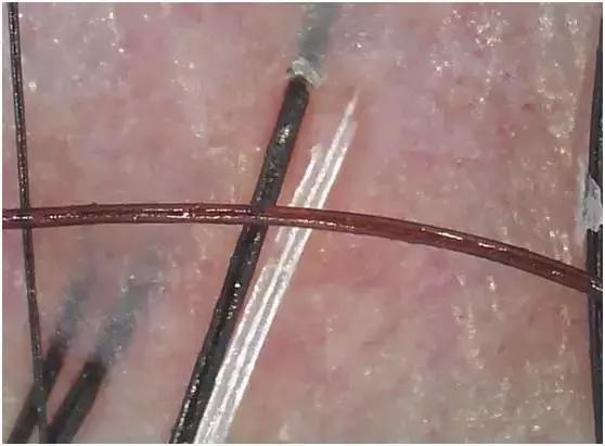 做头皮护理的十大好处,头皮理疗和护理