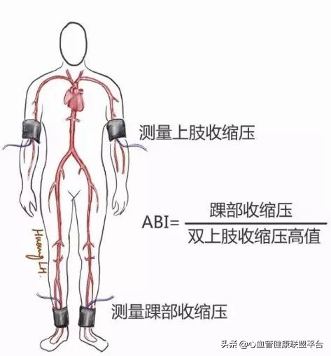 硬核科普｜血压检测不能少，动脉硬化你知多少？
