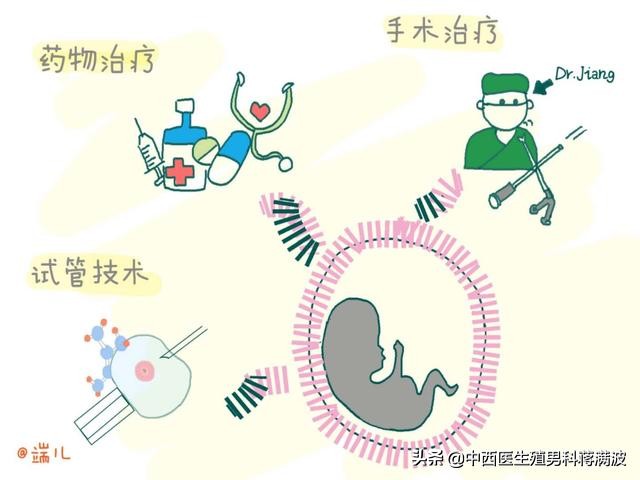 复发性流产的知识都包括在这4个方面啦！