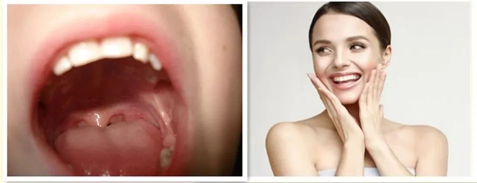 15天众筹10万元，MANYKA（麦蜜卡）产品的魅力何在？！