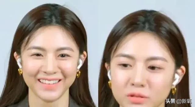 脸松弛下垂做哪种整形,面部下垂整形方法