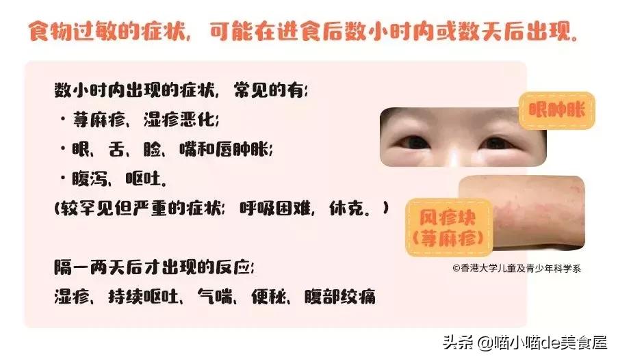 宝宝香肠怎么做不翻车,宝宝牛肉香肠8个月辅食