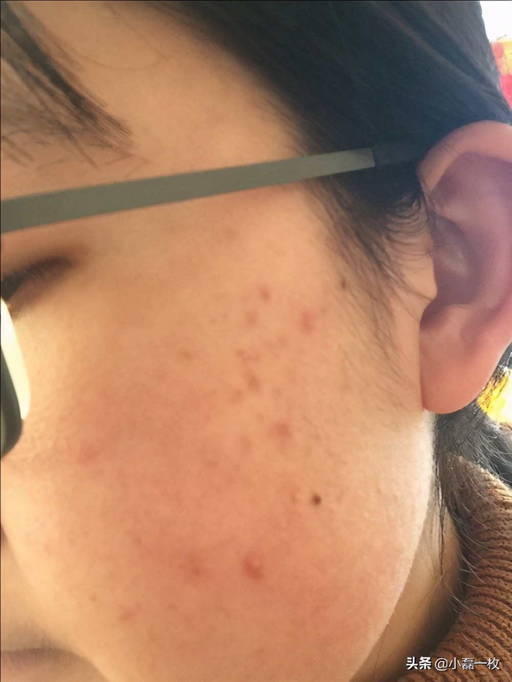 有哪些好用的祛痘印的产品,有哪些比较好的祛痘印产品